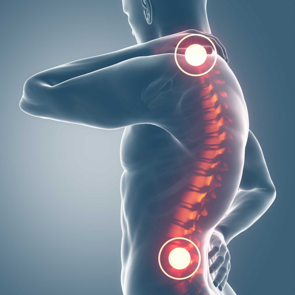 Il Dolore cronico - Dr Giuliano Lo Bianco - Specialista in Anestesia e Terapia del dolore